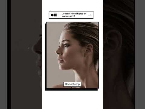 How Nose Shapes Impact Side Profile on Women