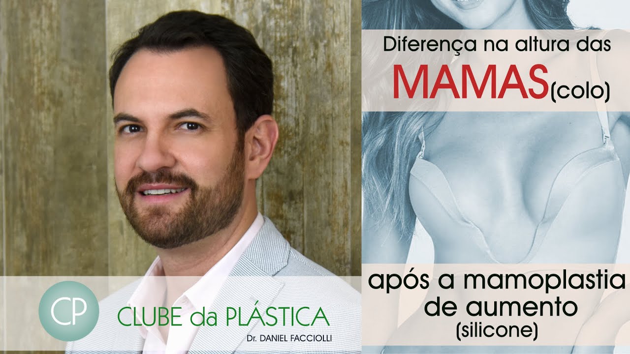 Clube da Plástica: diferença na altura do colo mamário após mamoplastia