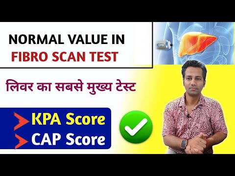 fibroscan test for liver | Normal KPA SCORE , CAP SCORE | fatty liver | Fibroscan normal range