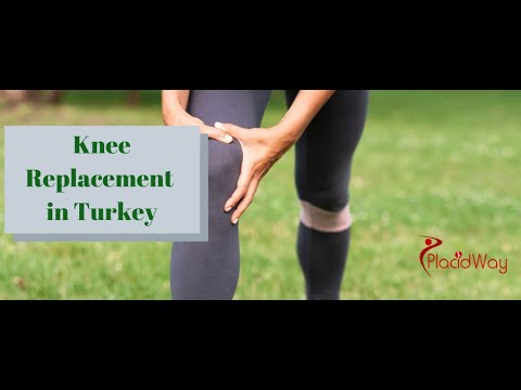 Get World-Class Care for Knee Replacement in Turkey 