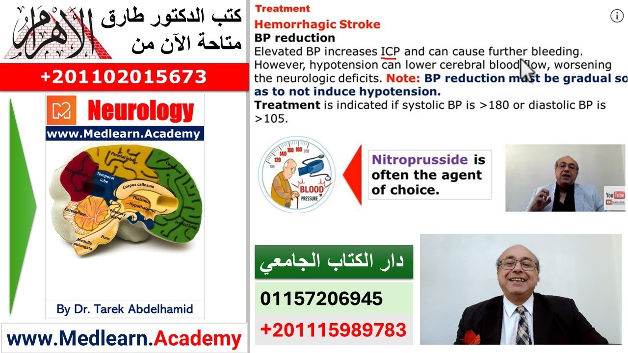 Stroke (IV) D #cme #internal_medicine #محاضرات_باطنة #usmle