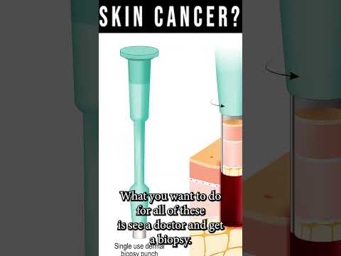 Heel Spurs Plantar Fasciitis BEST Home Treatment 2022