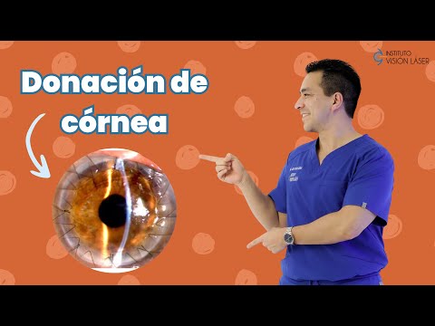 Donación de córneas (MITOS)