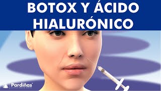 Ácido hialurónico y botox - Tratamiento para las arrugas en la cara ©