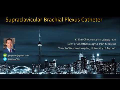 Ultrasound-Guided Supraclavicular Brachial Plexus Catheter Insertion