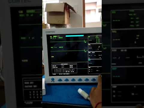 Puerta trasera descubierta en monitores de pacientes fabricados en China: Contec CMS8000 plantea pr