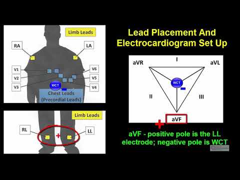 online ecg interpretation course samples