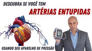 Teste Caseiro Aponta ARTÉRIAS ENTUPIDAS || Dr. Moacir Rosa