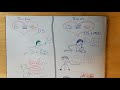 Down Syndrome And Autism Spectrum Disorder