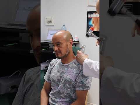 How To Remove Pain In Neck? Toksen Hammer Tapping