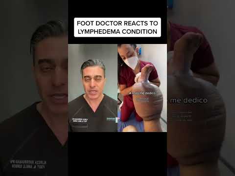 Lymphedema does WHAT to your leg?!?