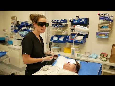 K-Laser Blue Derma - Carly Whytcross - Rosacea