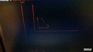 Hide From Myself - Buck 65 - Untitled/Dirt Bike 2/Track 24