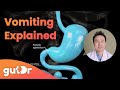 What Happens During Vomiting The GutDr Explains 3D Gut Animation