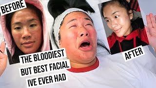 WHY I LOVE THIS FACIAL || LingKT