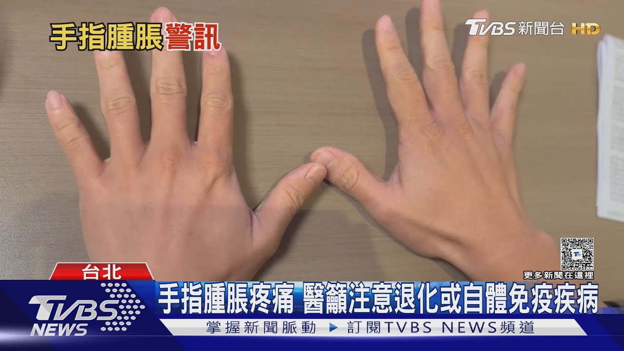 手指出現腫脹疼痛? 當心「這些疾病」引起 醫師:延誤就醫下場慘!