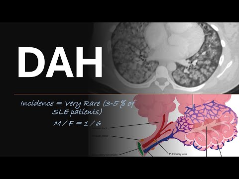 DAH - Understanding DIFFUSE ALVEOLAR HEMORRHAGE  #LungHealth #MedicalEducation #RespiratorySystem