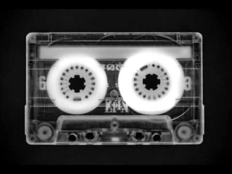 Moosfiebr - Curious Fingers (Fashion Viktims Rmx)