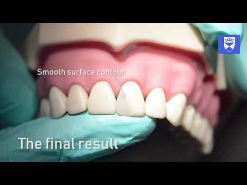 The direct anterior composite restoration