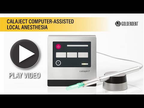 Calaject Computer-Assisted Local Anesthesia - Pain Free Dental Injections