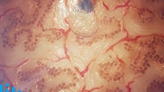 PRINTING SKIN -- Mind Blow #95