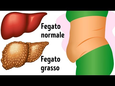 A vermi e pinworms Termine di vita di lyambliya