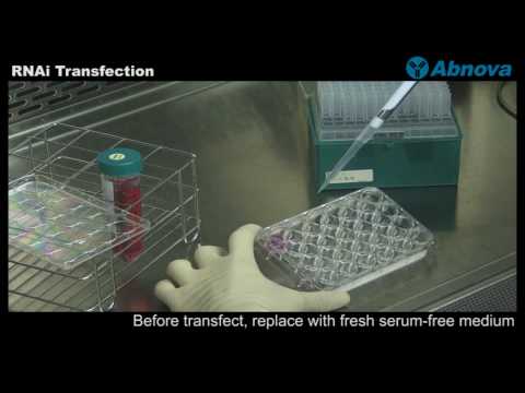 RNAi Transfection
