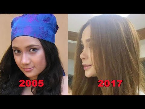 Arci Munoz Plastic Surgeries Through The Years
