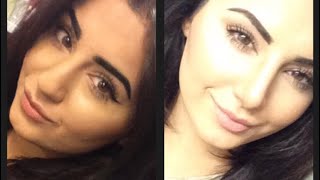 MY NOSE JOB EXPERIENCE AND VLOG | Zhila Panjavi