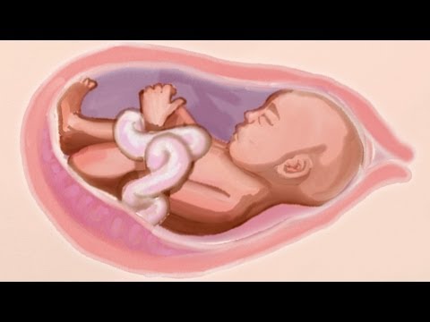 Das Knirschen der Gelenke in den Händen und Knien Rückenschmerzen im rechten Schulterblatte und unteren Rücken