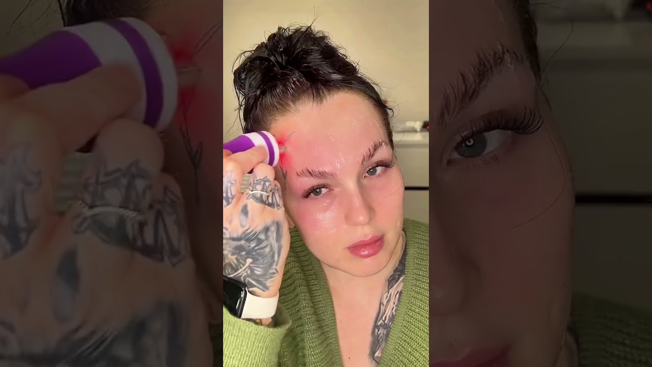 Bye Puffy Eyes & Loose Skin with Radiofrequency Treatment from Home 🌟 ✨! #radiofrequency