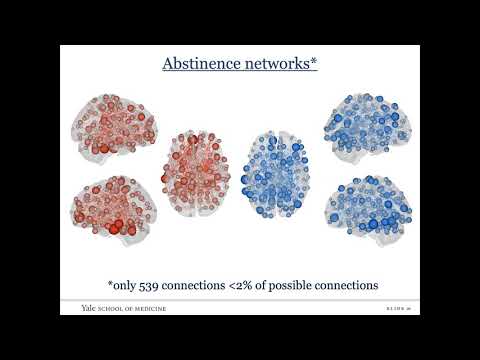 Innovators in Cog Neuro - Sarah Yip 11/10/2021