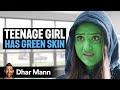 GIRL Has GREEN SKIN Dhar Mann Studios