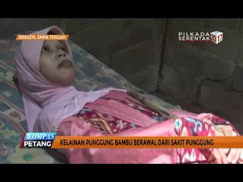 Sulami, Kisah Mengharukan "Manusia Kayu" Asal Sragen