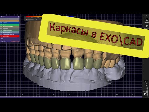 Моделировка циркониевого каркаса в EXOCAD полностью Моделирование зубов на компьютере. Керамика