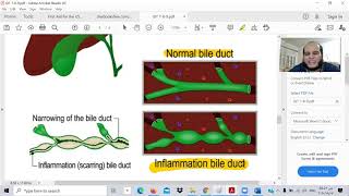 GIT 7a - Pathology C  -Ibrahem Gamal - Toxic usmle - شرح المعادلة الامريكية بالعربي