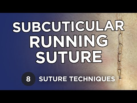 Subcuticular Running Suture - Learn Suture Techniques