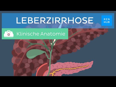 Leberzirrhose: Ursachen, Symptome, Diagnose, Behandlung | Kenhub