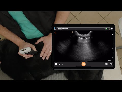 Rule Out Pneumothorax