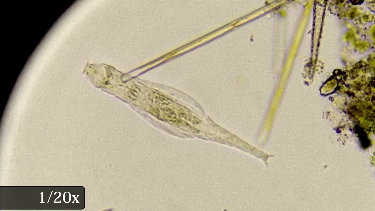 Checking Rotifers Under Microscope