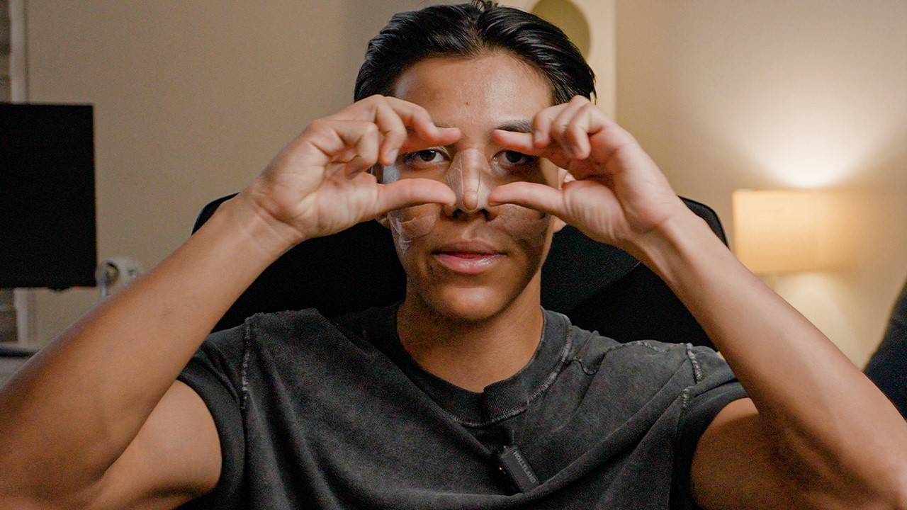 Me Operé La Cara... Salió Mal? - YANPOL