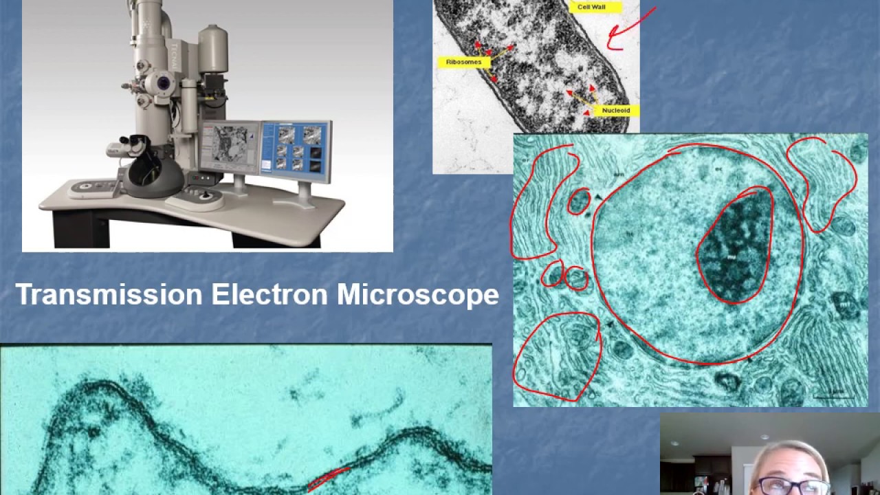 Chapter 4: Microscopy