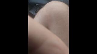 Babbling Idiot Speaks Nonsense