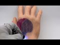 Light-activated tattoo inks make skin a rewritable, animated canvas
