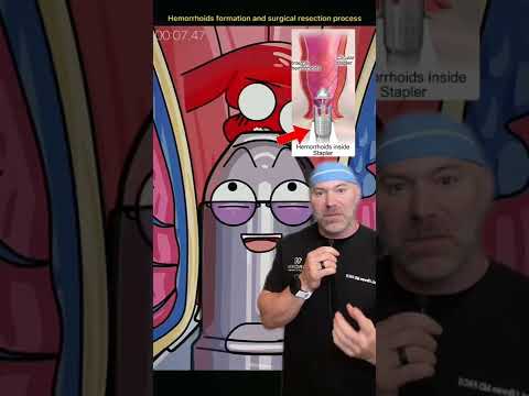 Fixing a Hemorrhoid 💩 #shorts