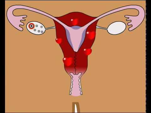 comment regler le cycle menstruel