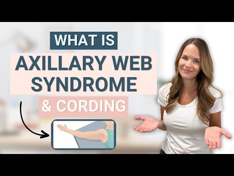 Axillary Web Syndrome or Cording - What is it? video modal