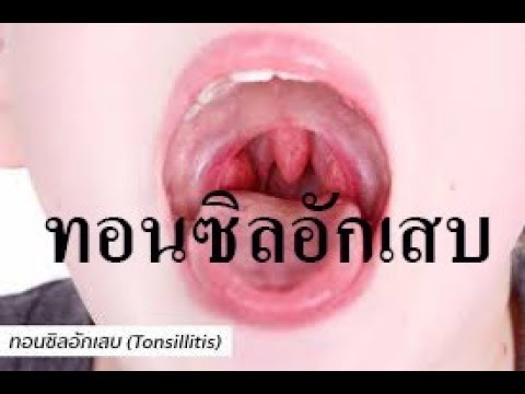 Elena Malysheva โรคสะเก็ดเงินสุขภาพโปรแกรม คลินิก Ekaterinburg สำหรับการรักษาโรคสะเก็ดเงิน
