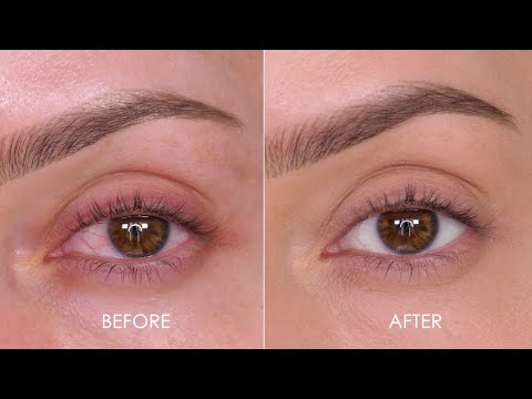 WOW! - How To Remove Eye Redness In Minutes | Shonagh Scott