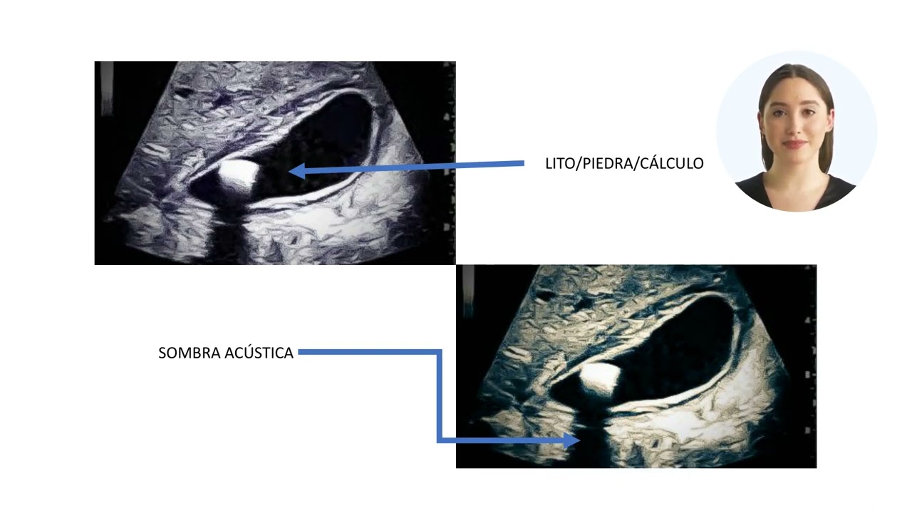 Miguel Angel Rico Hinojosa-32